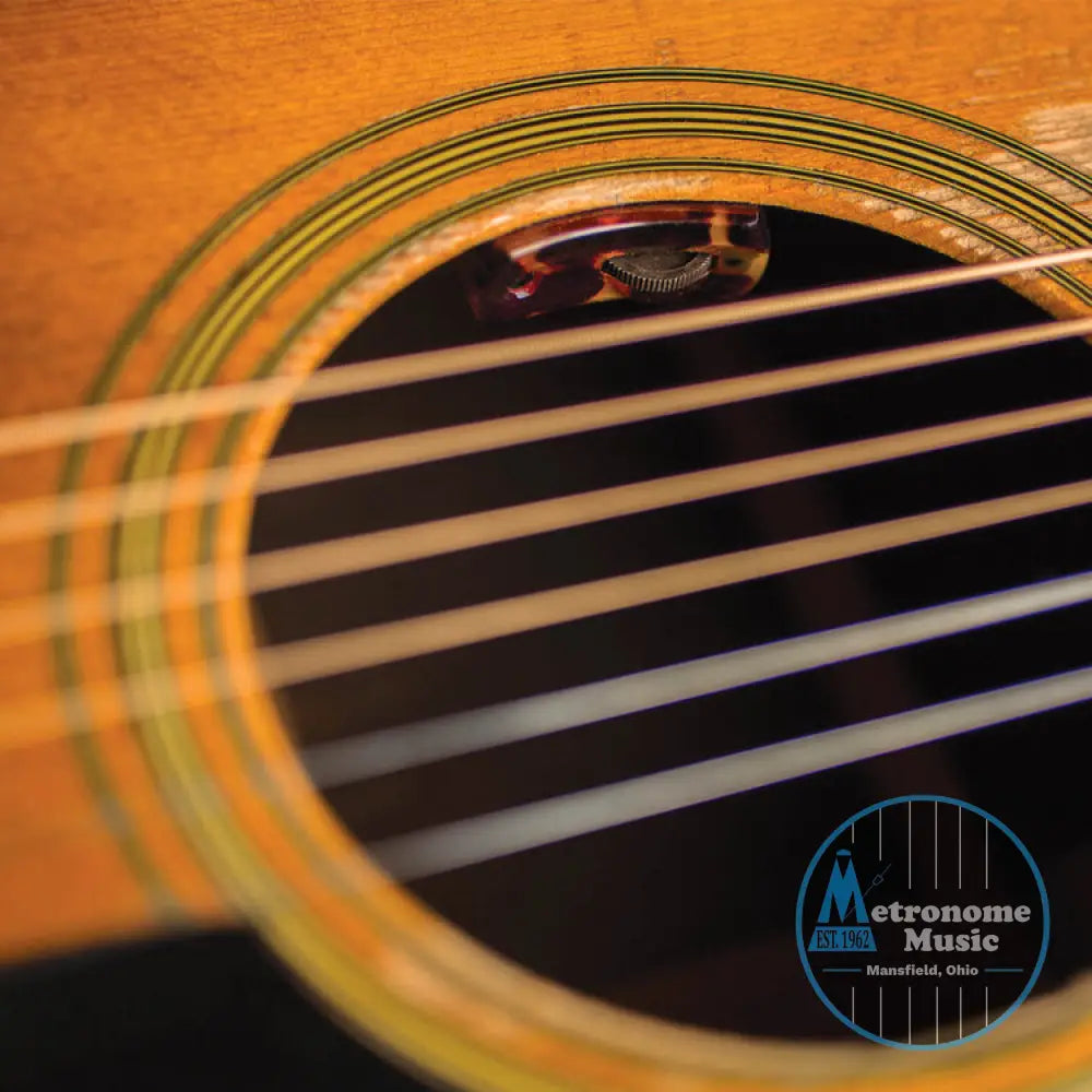 L.R. Baggs LYRIC Acoustic Guitar Microphone - Metronome Music Inc.