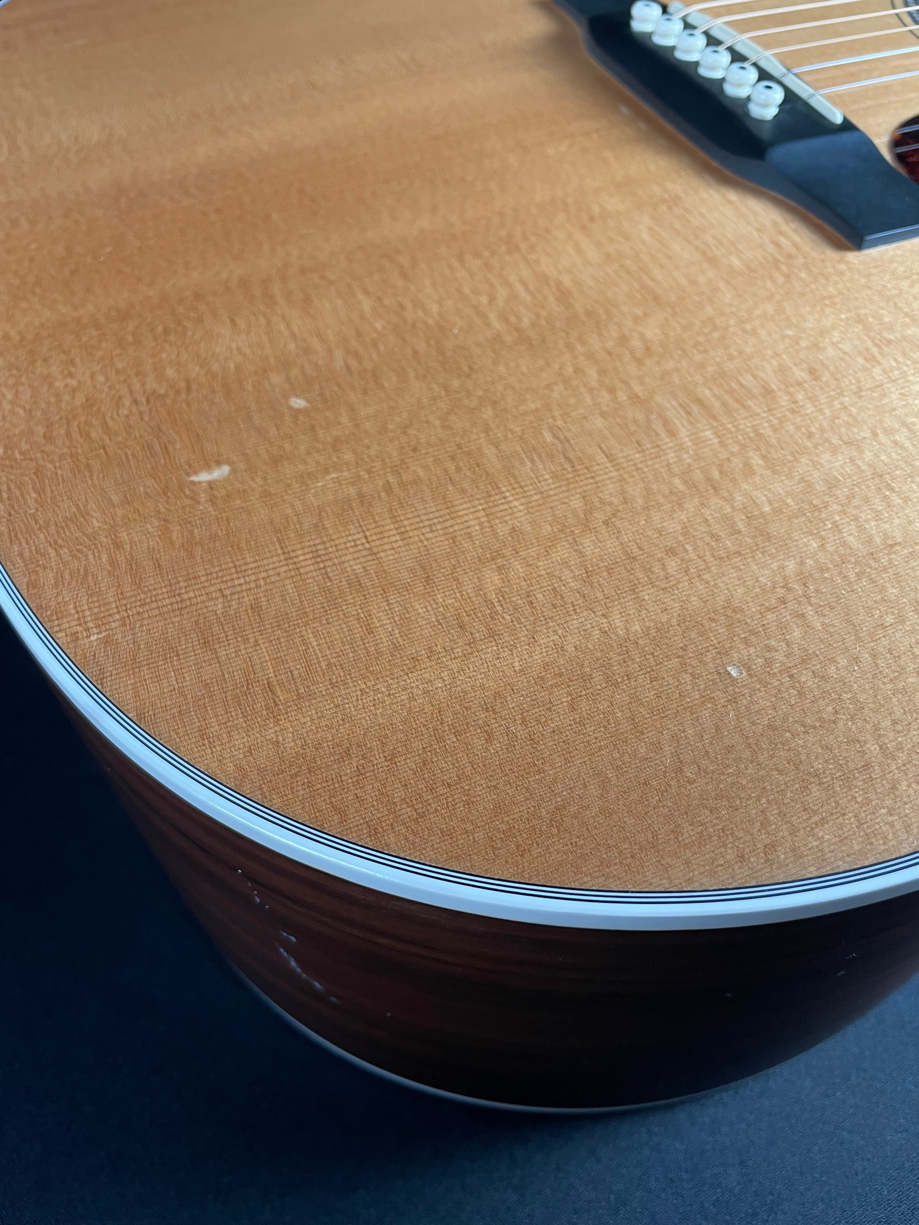 Martin D-16RGT LR Baggs Anthem w/OHSC - Natural (2015) - Metronome Music Inc.
